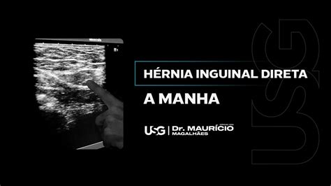 ultrassonografia para hernia inguinal